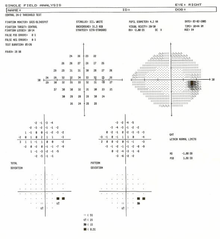 Test of Visual Field Machine